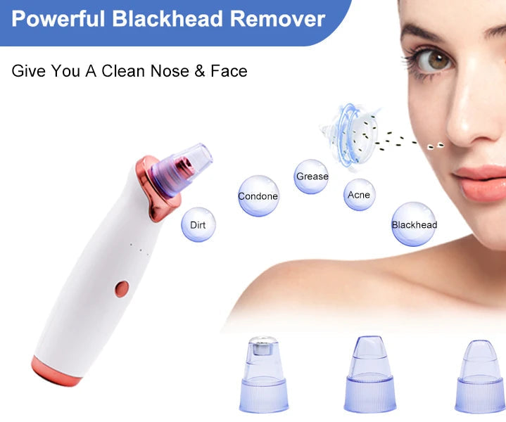 Blackhead Remover Vacuum – T-Zone Deep Clean Tool