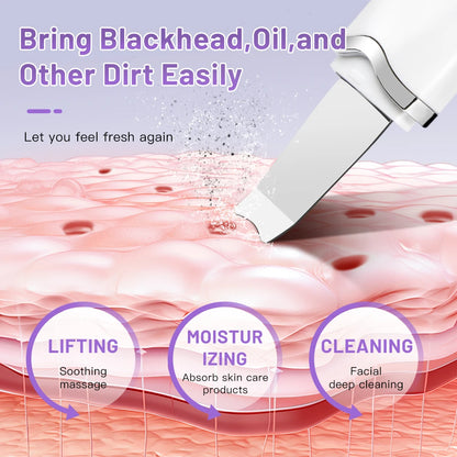Ultrasonic Peeling Machine