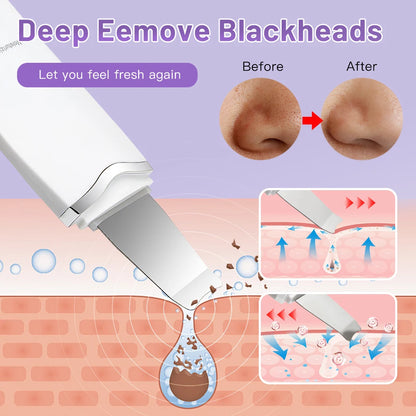Ultrasonic Peeling Machine