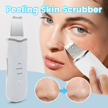Ultrasonic Peeling Machine