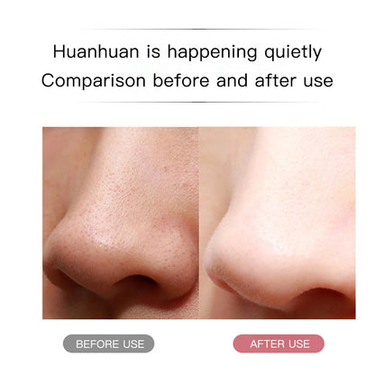 Ultrasonic Peeling Machine